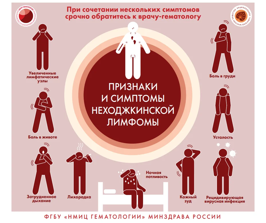 Признаки и симптомы неходжкинской лимфомы