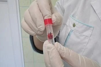 В регионе обсудят вопросы борьбы с гепатитом С